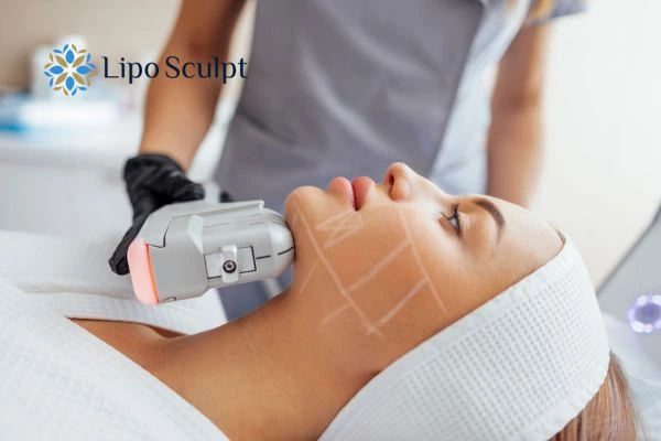 HIFU vs Botulinum Toxin: Understanding the Differences 1 HIFU vs Botox Brierley Hill What is the best option for you?